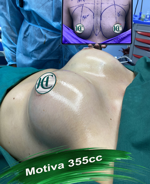 Slider image (3) Dr. Ho Co - Aesthetics and Plastic Surgery in Vietnam